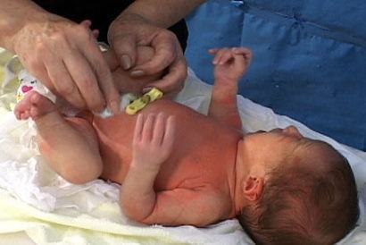 como cuidar do umbigo do bebe