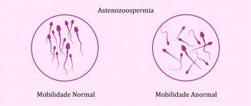 astenozoospermia 490x208