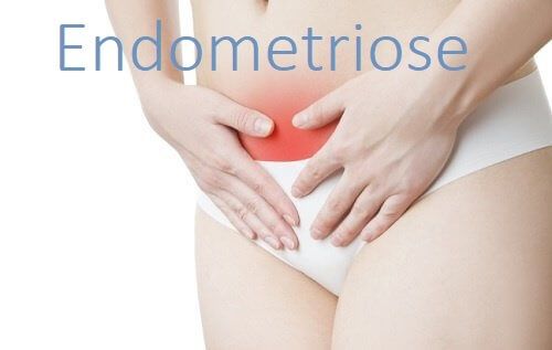 Diagnóstico de Endometriose, E Agora, Remédios
