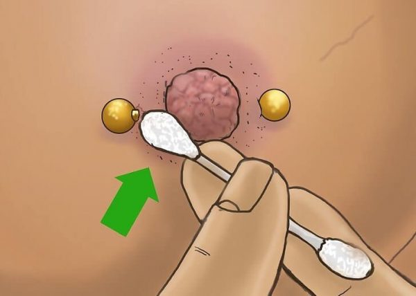 piercing no mamilo inflamado